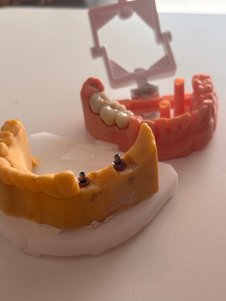 Precision Dental Work