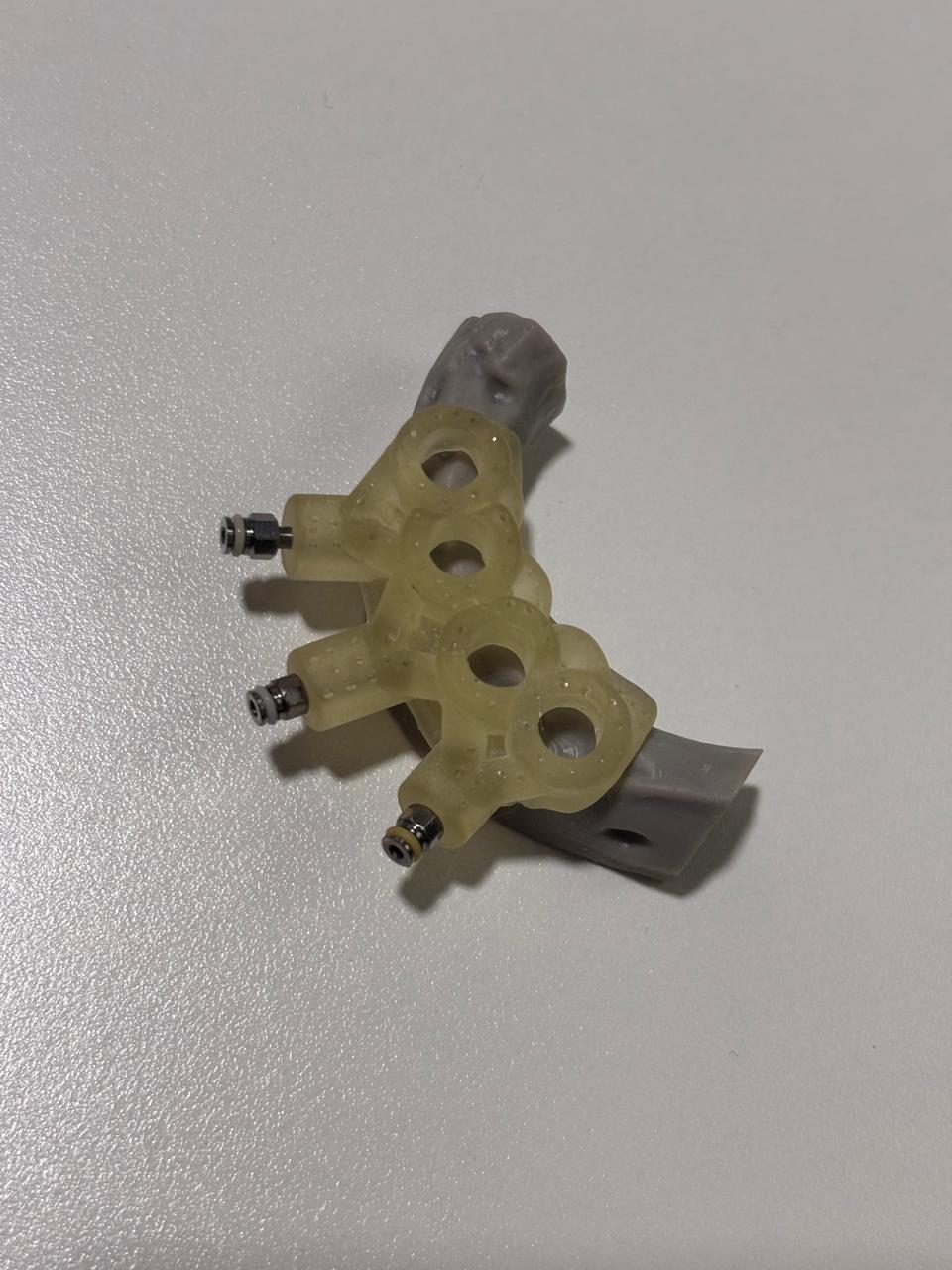 Surgical Guide Template